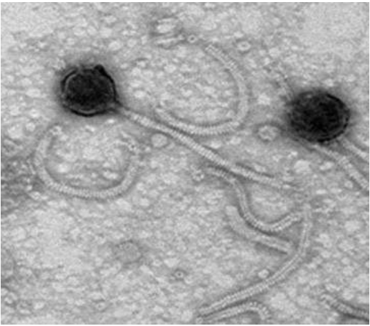 Vibrio harveyi 감염 박테리오파지